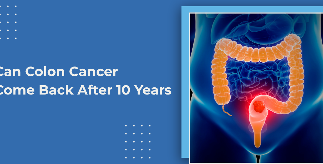 Can Colon Cancer Come Back After 10 Years?