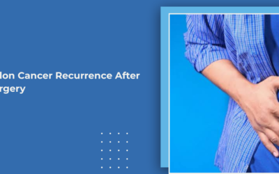 Colon Cancer Recurrence After Surgery