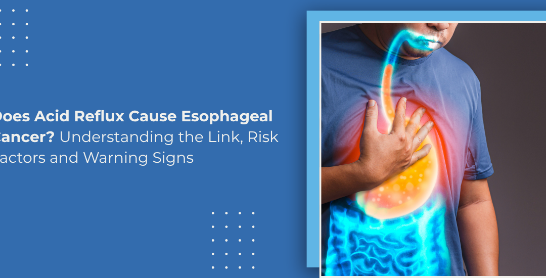 Does Acid Reflux Cause Esophageal Cancer? Understanding the Link, Risk Factors and Warning Signs