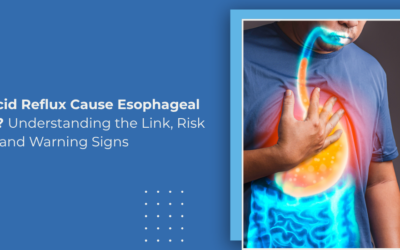 Does Acid Reflux Cause Esophageal Cancer? Understanding the Link, Risk Factors and Warning Signs