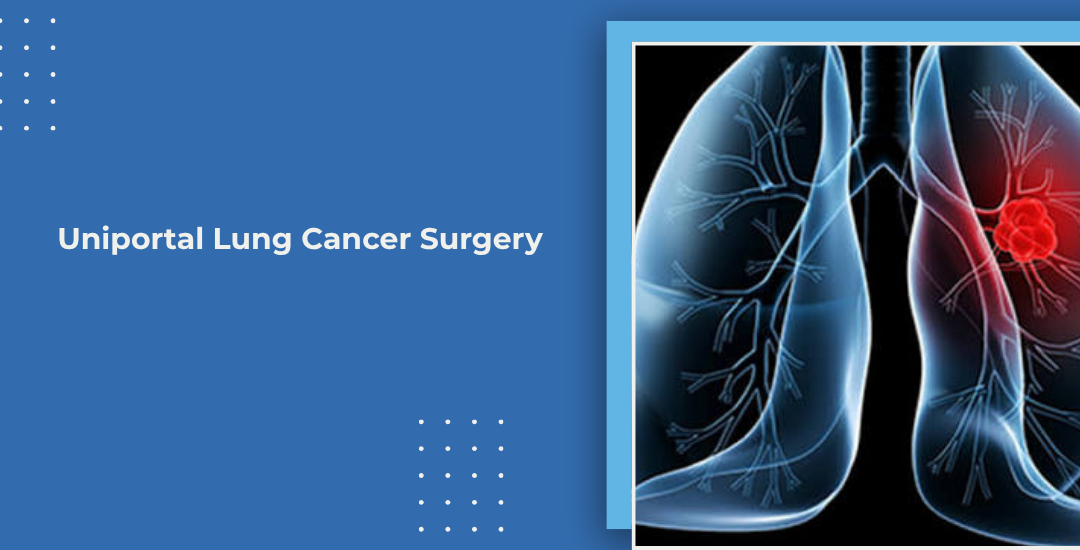 Uniportal Lung Cancer Surgery