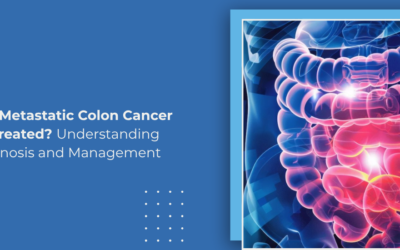 Can Metastatic Colon Cancer Be Treated? Understanding Prognosis and Management