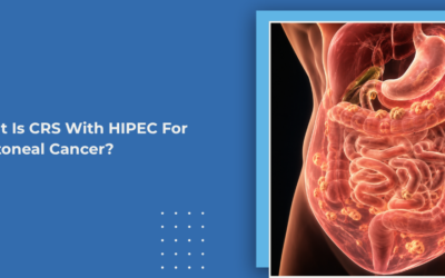 What Is CRS With HIPEC For Peritoneal Cancer?