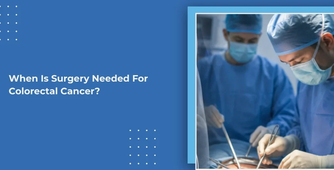 When Is Surgery Needed For Colorectal Cancer?