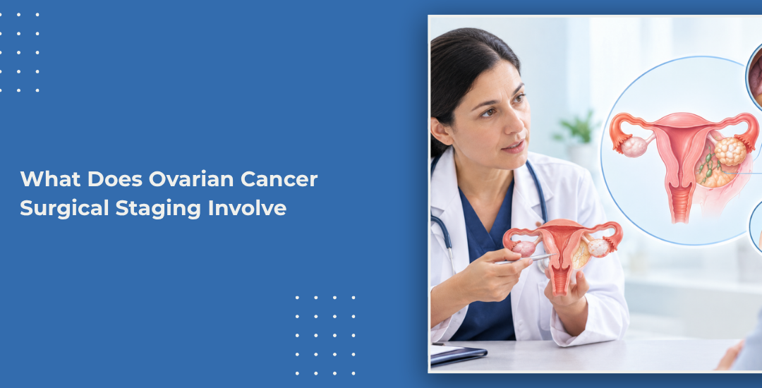 What Does Ovarian Cancer Surgical Staging Involve?
